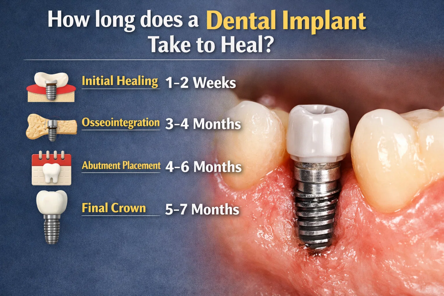 how long does an implant take to heal