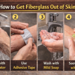 how to get fiberglass out of skin